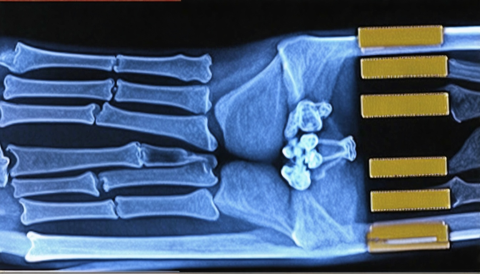 Radiographic Anatomy Basics