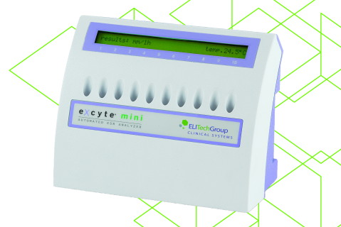 Excyte Mini Overview Erythrocyte sedimentation rate (ESR) Excyte Mini Overview Erythrocyte sedimentation rate (ESR)