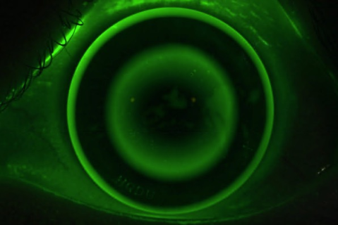 EyeSpace® Forge Ortho-K® Certification (FRG1)