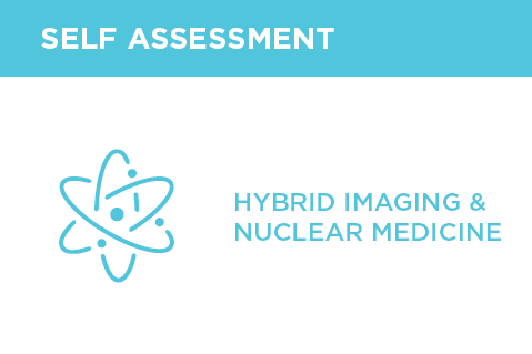 PET-CT in Primary and Secondary Abdominal Tumors  Hybrid Imaging (990)