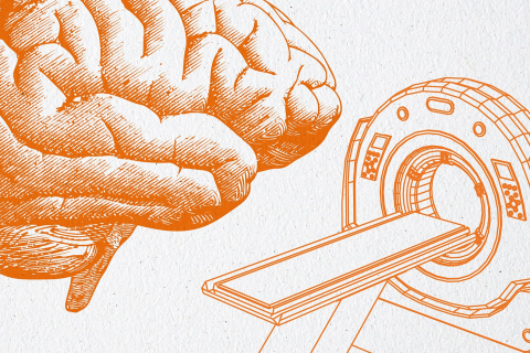Applying the 2024 MS Diagnostic Criteria: A CME for Neurology Professionals