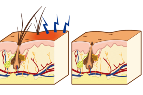 A case of Canine Atopic Dermatitis in a 14-month-old female French Bulldog