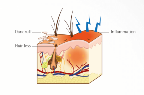 A case of flea allergy dermatitis in a male English bulldog