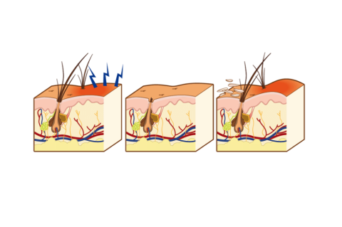 A case of Canine Atopic Dermatitis in a 14-month-old female French Bulldog
