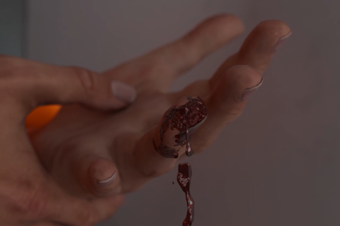 Finger and Hand Injuries (PBTVC0001)