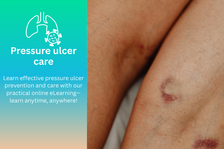 Pressure Ulcer Prevention (PC64)