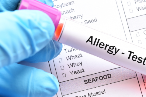 Food Allergy Awareness (FSE04)