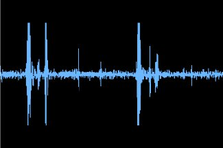 3rd degree atrioventricular block