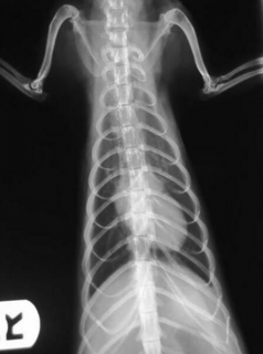 Acquired valvular disease