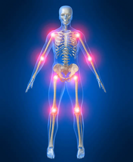 Tư vấn dùng thuốc giảm đau cho bệnh nhân cơ xương khớp tại nhà thuốc (TGD)