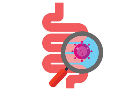 Rối loạn ruột kích thích - Các biểu hiện điển hình và điều trị (RLRKT)